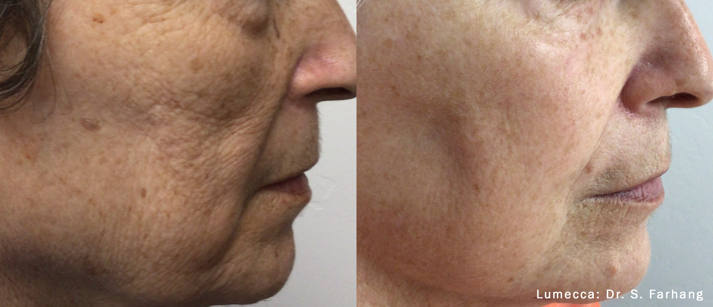 Homeostasis and metabolic balance supporting radiant skin