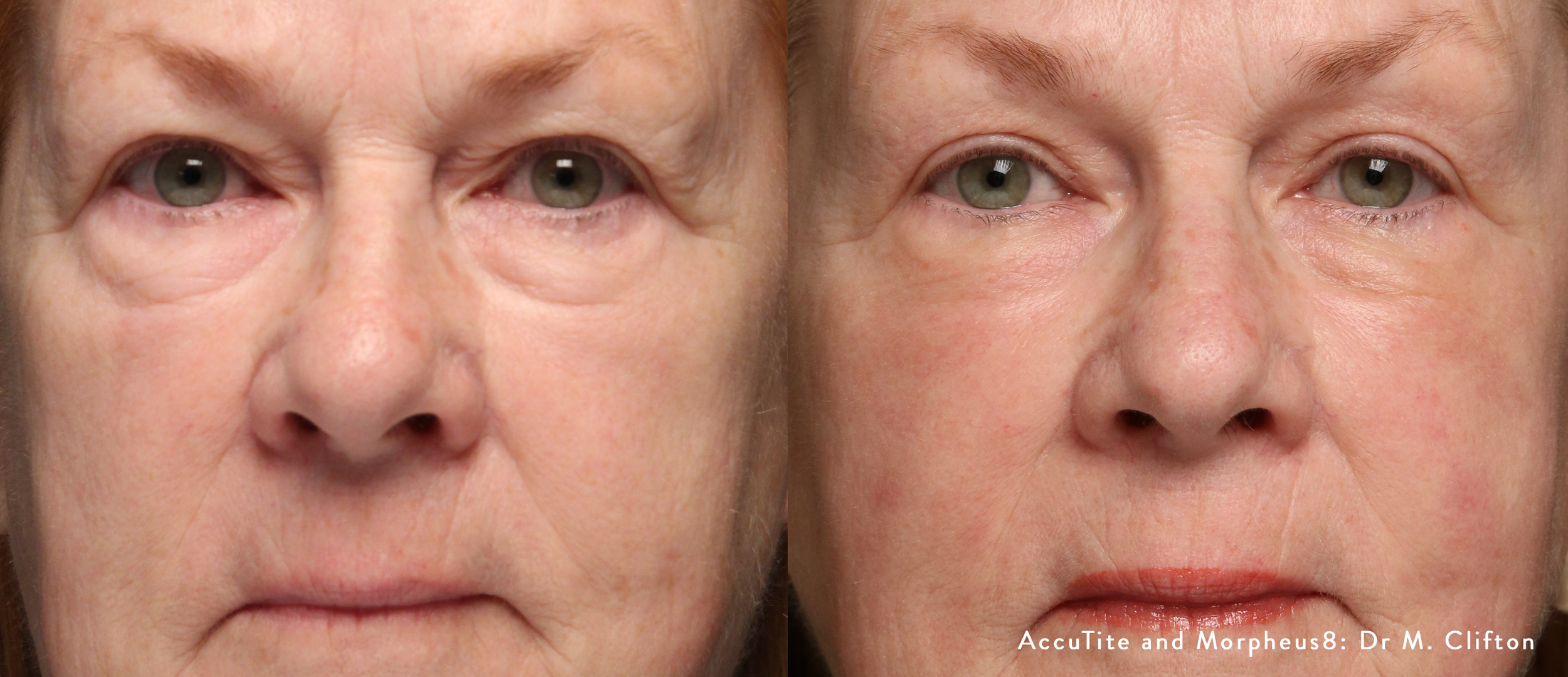 Longevity therapies supporting recovery and vitality at Reborn Health & Aesthetics